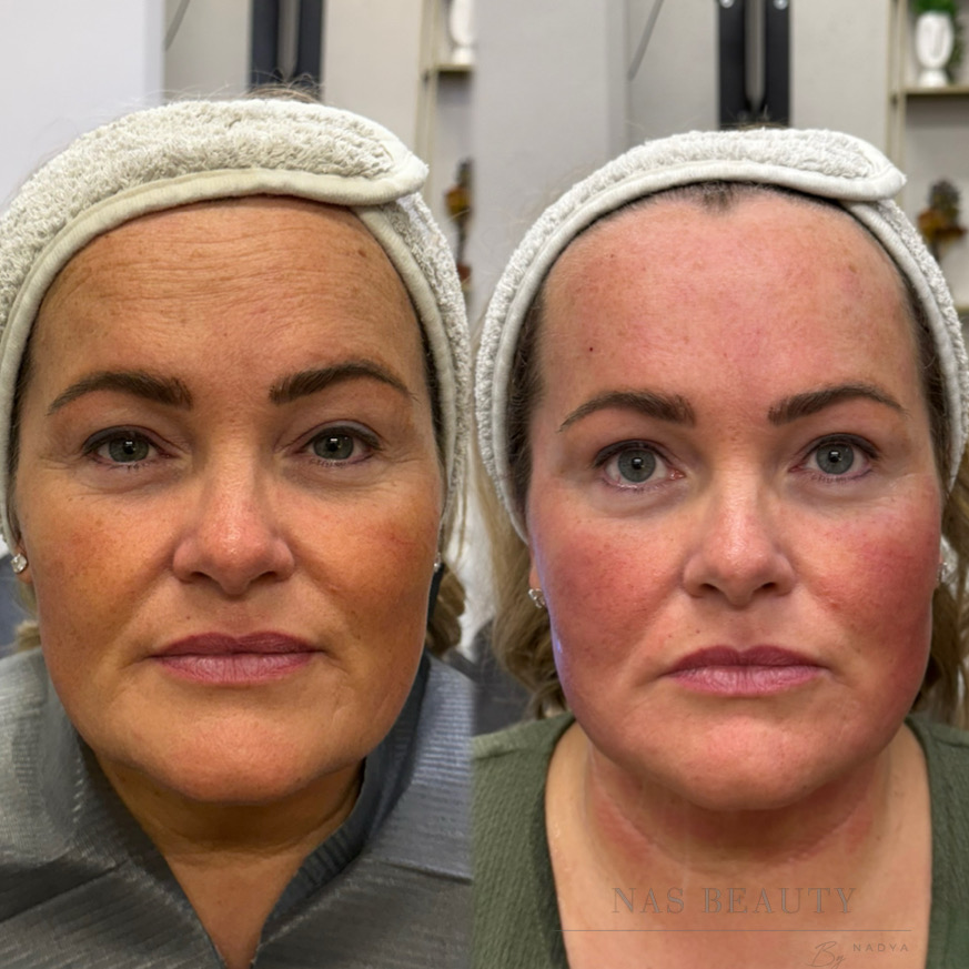 Contouring result at NAS Beauty by Nadya, Northampton