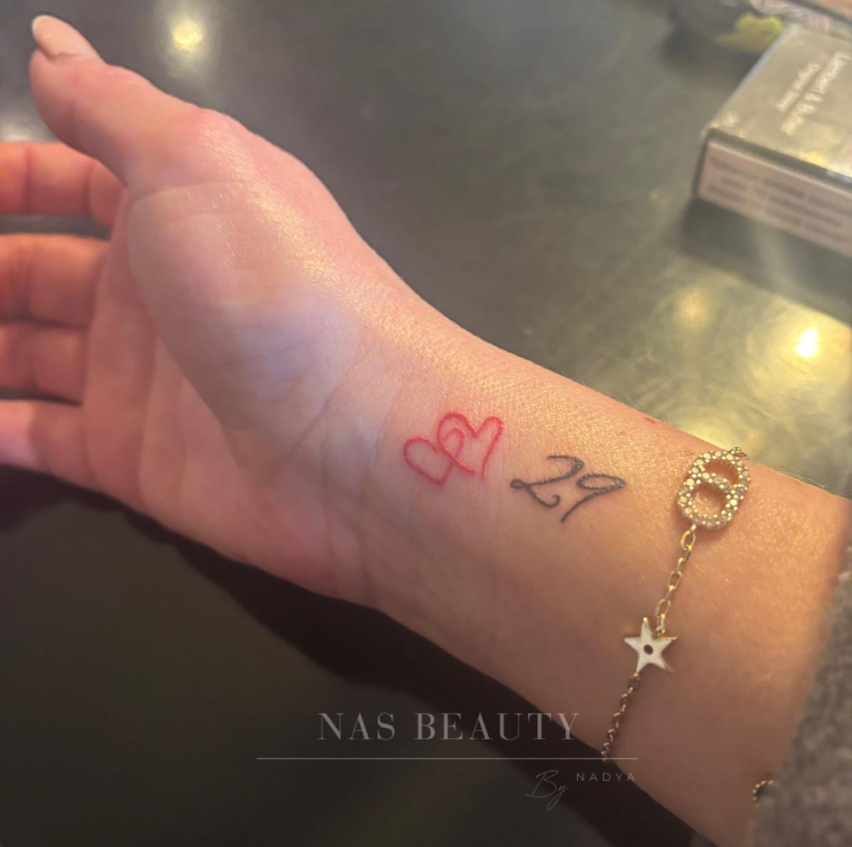 Injectables result at NAS Beauty by Nadya, Northampton